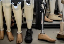 Для чего нужны протезно-ортопедические изделия?